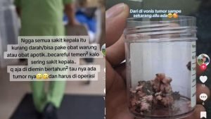 Viral! Wanita di Jateng Sering Sakit Kepala, Tak Disangka Ternyata Tumor Otak