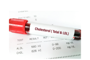 Tanda-tanda Kolesterol Tinggi di Pagi Hari yang Sering Disepelekan, Apa Saja?